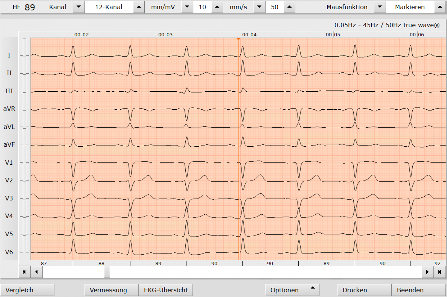 Ekg Kardiologische Praxis Lippstadt